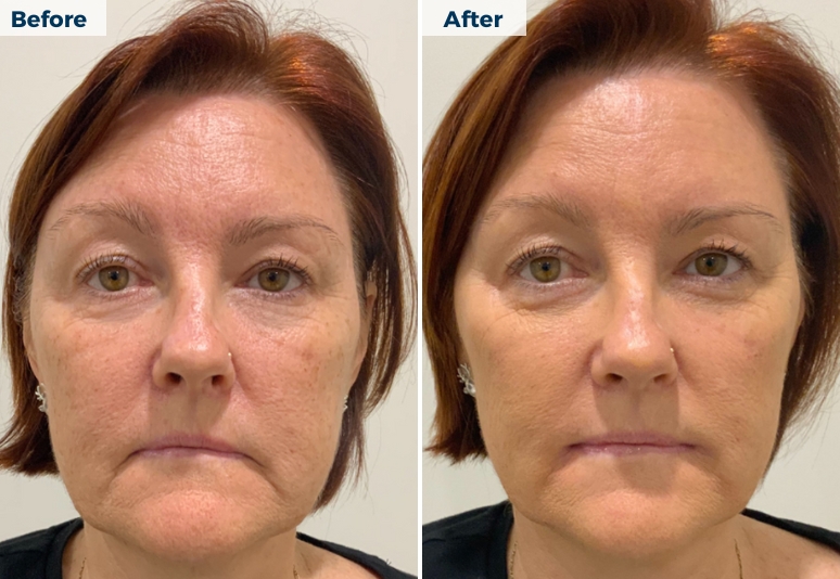 Skin Repair Skin Cancer Centre in Townsville, Queensland